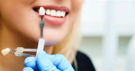 lv dentist|affordable dentist las vegas.